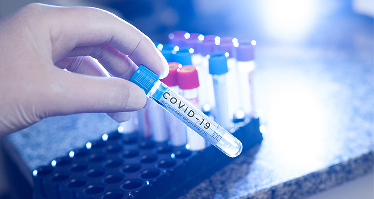 Ajustes promove pesquisa sobre imunização contra Covid-19